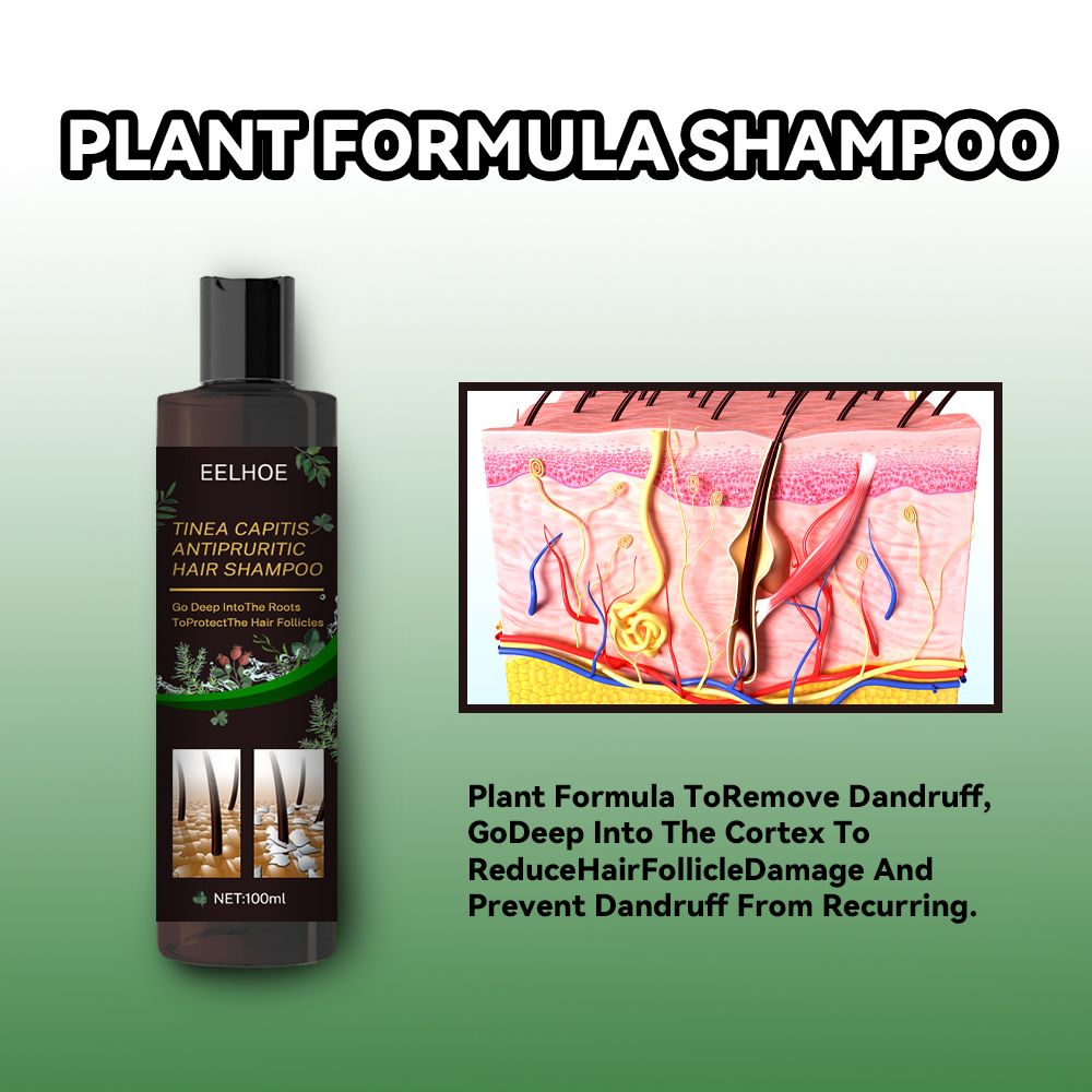 Anti-Dandruff Shampoo,Shampoo For Scalp Prone To Folliculitis, Dermatitis, Dandruff, Itchy And Flaky Scalp,Treats Dandruff And Seborrheic Dermatitis,Anti-Itch Shampoo